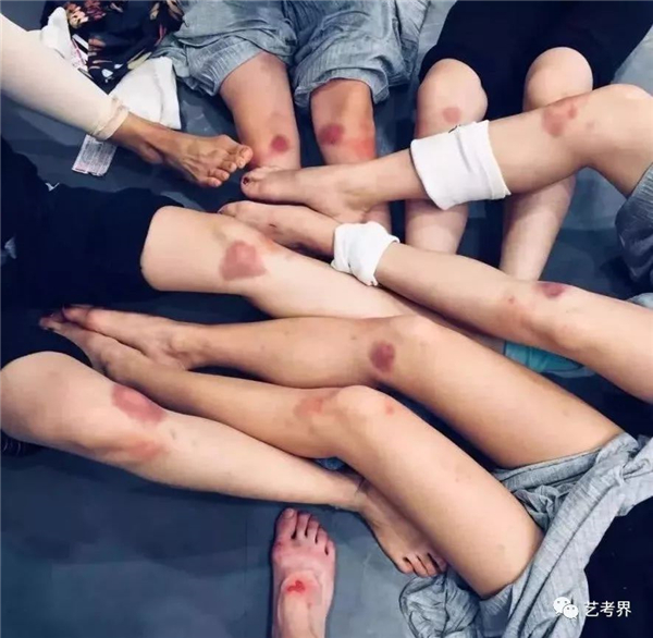 跳舞的伤痛